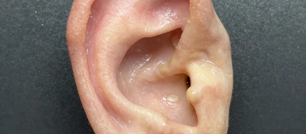 Understanding Conch and Helix Pain Levels and Ear Anatomy